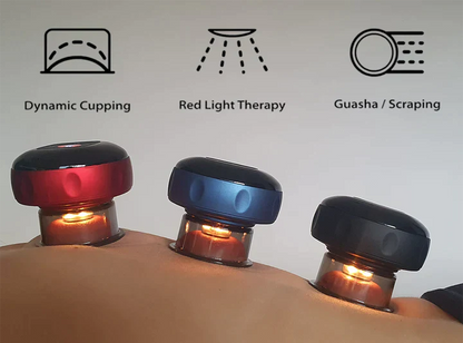 Smart Cupping Therapy Device